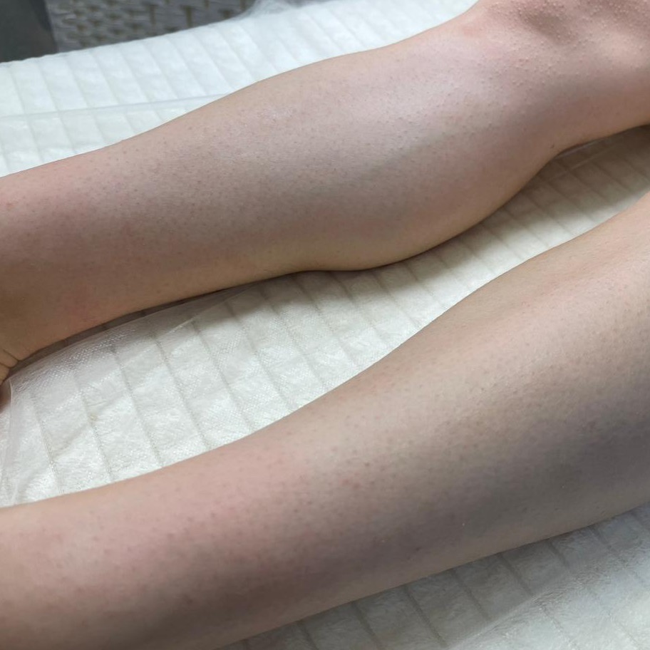 Изображение зоны ног после процедуры шугаринга, показана гладкая кожа без волос